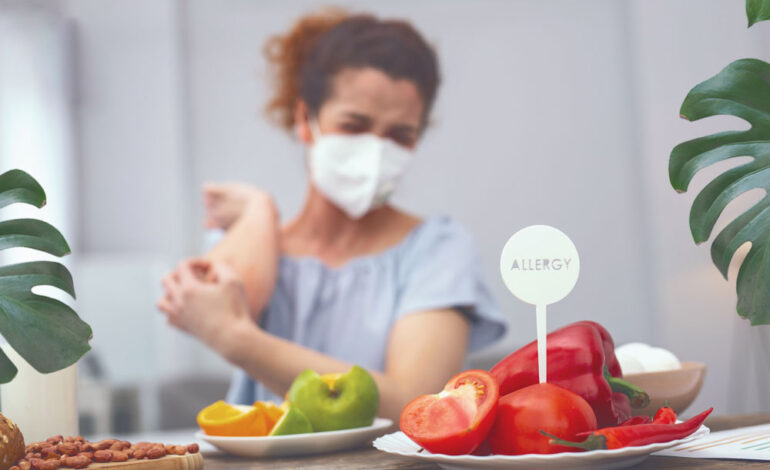 5 Ways Food Sensitivities Mask as Allergies in Chicago